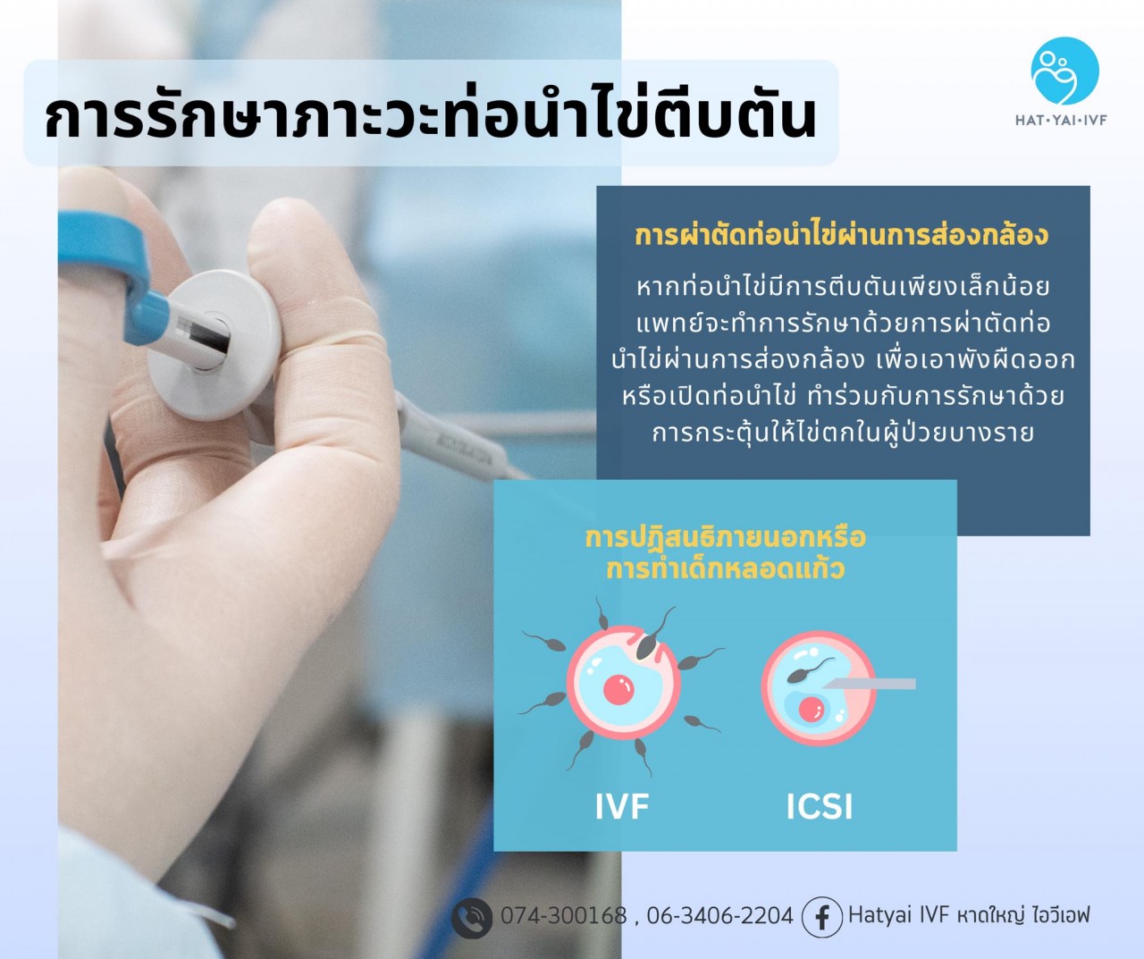 การรักษาภาวะท่อนำไข่ตีบตัน